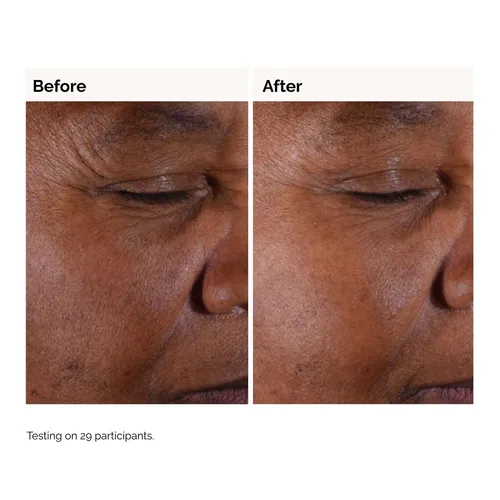 The Ordinary Glycolic Acid 7% Exfoliating Toner 240ml | דה אורדינרי טונר חומצה גליקולית 7% לחידוש והבהרת העור 240 מ"ל