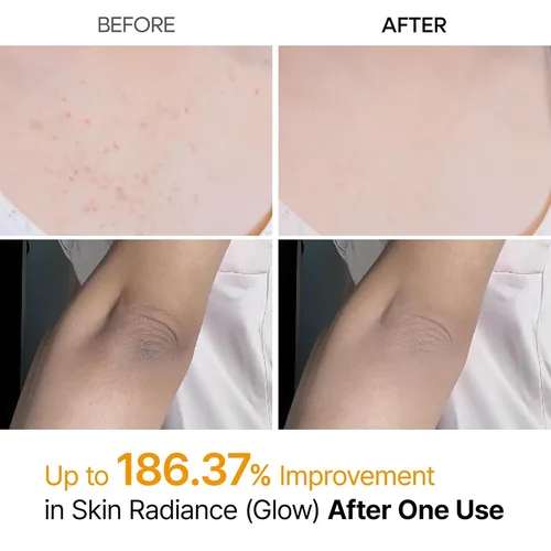 ד"ר מילקסין | Dr.Melaxin Peel Shot Exfoliating Kojic Acid Turmeric Spray ספריי פילינג עוצמתי לחידוש והבהרת עור הגוף וכפות הרגליים - 200ml