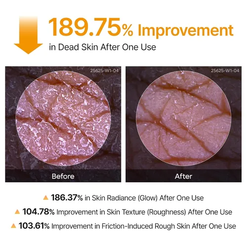 ד"ר מילקסין | Dr.Melaxin Peel Shot Exfoliating Kojic Acid Turmeric Spray ספריי פילינג עוצמתי לחידוש והבהרת עור הגוף וכפות הרגליים - 200ml