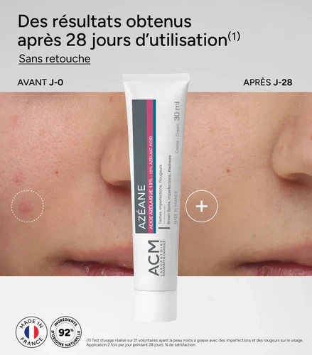 ACM Azeane 15% Azelaic Acid Cream 30ml | ACM אזאן קרם חומצה אזלאית 15% 30 מ"ל