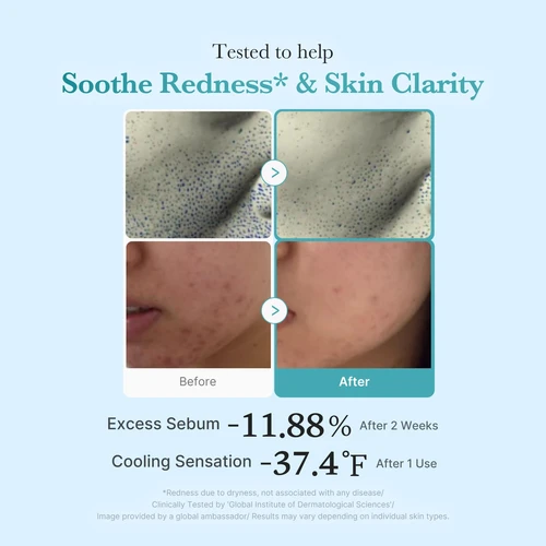 Medicube Azelaic Acid Niacinamide Clear Toner 4% 250ml | מדיקיוב טונר חומצה אזלאית ניאצינמיד 4% 250 מ"ל