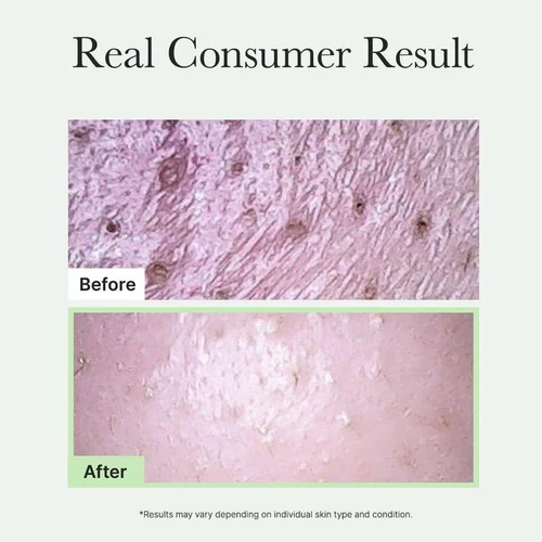 Arencia Fresh Green Rice Mochi Cleanser 120g | ארנסיה ניקוי פנים מוצ'י אורז ירוק 120 גרם