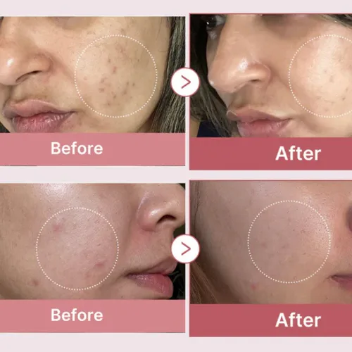 Medicube / מדיקיוב