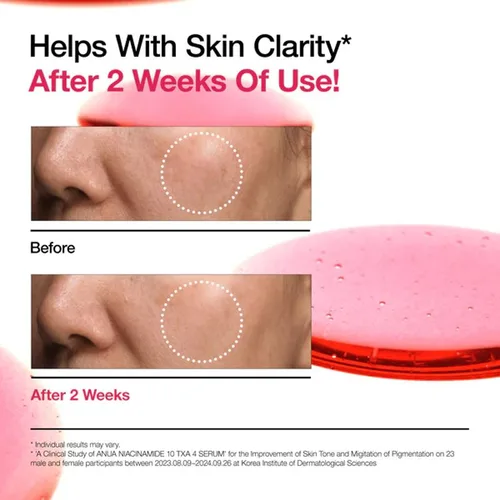 אנואה סרום ניאצינאמיד 10% ו-TXA 4% להבהרה - Anua Niacinamide 10% + TXA 4% Dark Spot Correcting Serum (30ml) - לטיפול בפיגמנטציה וכתמי עור