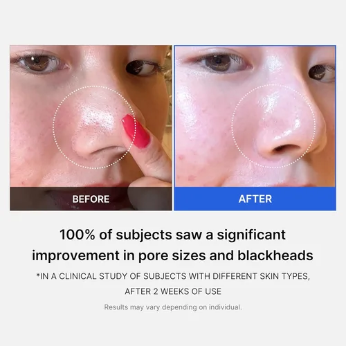 מדיקיוּב פדים לניקוי וצמצום נקבוביות - Medicube Zero Pore Pad 2.0 (70 pads) - לטיפול בנקבוביות פעורות ומראה עור חלק