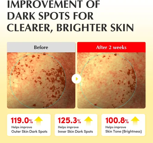 איקוול ברי טונר ויטמינים להבהרה וזוהר - EQQUALBERRY Glow Filter Vitamin Illuminating Toner (150ml) - לטיפול בפיגמנטציה ומראה עור קורן